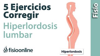 5 ejercicios para corregir la Híperlordosis lumbar o exceso de curvatura de espalda