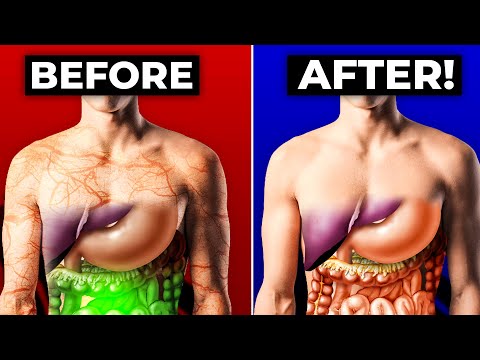 How To Reset Your Gut Health