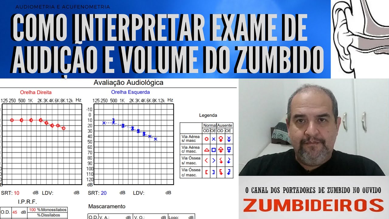 Como Interpretar Exame de Audição e Volume de Zumbido