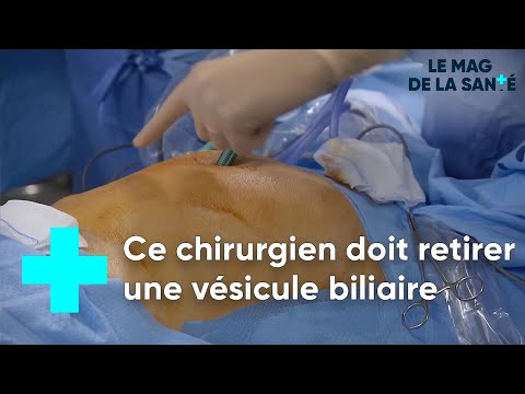 La cholécystectomie : quand il faut retirer la vésicule biliaire - Le Magazine de la Santé