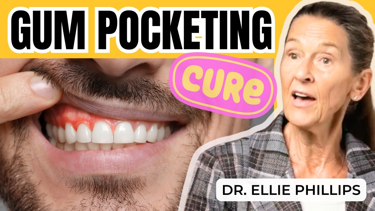 Cure Gum Pocketing to Cure Gum Disease