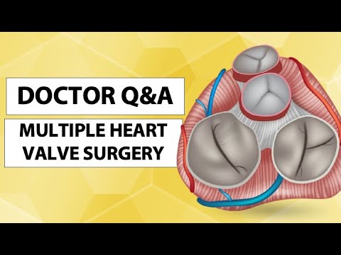 Understanding Minimally Invasive Heart Valve Surgery