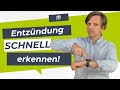 Dr Teichgräber Erklärt Warum Der CRP Schnelltest Beim Hausarzt So Wichtig Ist