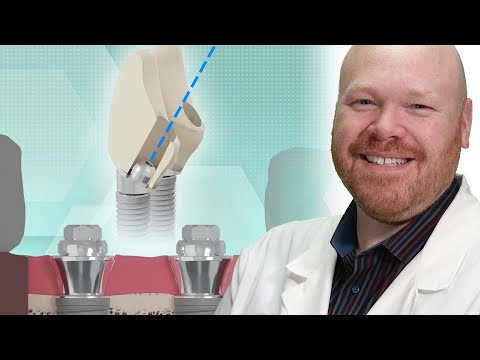 Nobel Biocare Multi-Unit Abutments