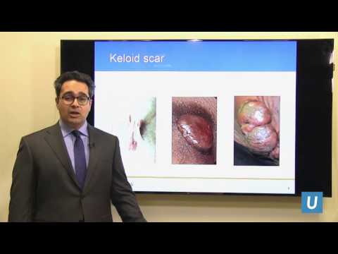 Scar and Keloid Management | Andrew Vardanian, MD | UCLAMDChat