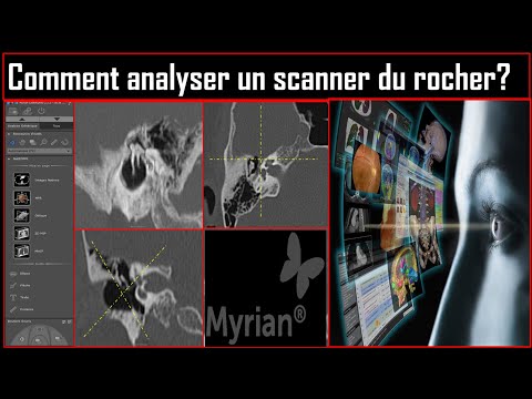 How to analyze a rock scan?