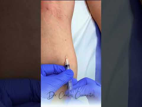 Carlos Cervantes-20