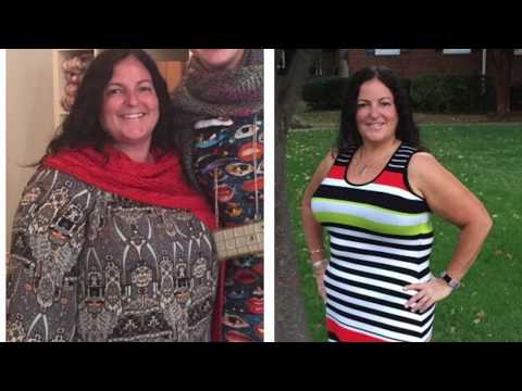 75-Pound Weight Loss in 9 Months--Forever a new person