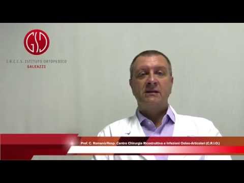 Pulizia • Sala articolazioni riso Aggraffatura del pollice