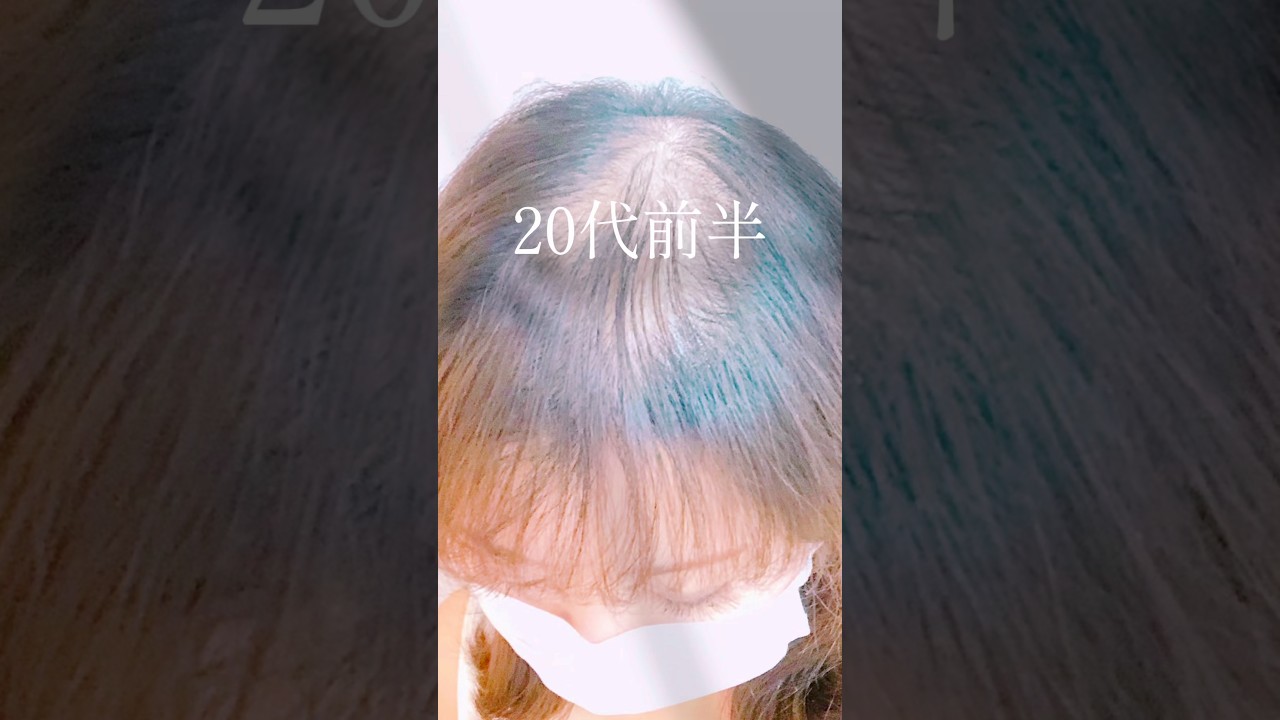 帽子が手放せなかった頃の私