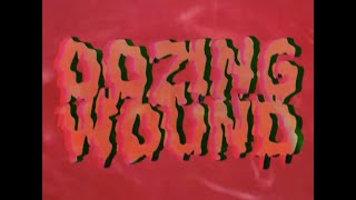 Oozing Wound - Surrounded by Fucking Idiots (Official Music Video)