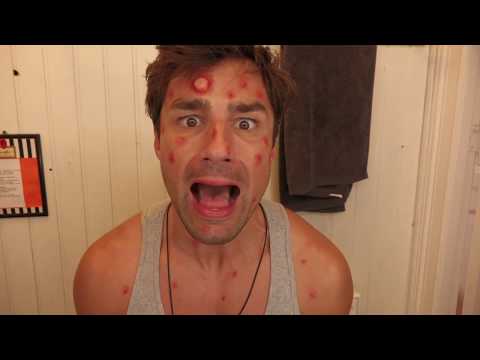 Sch*** Moskitos | DESPACITO (Parodie) - Luis Fonsi feat. Daddy Yankee