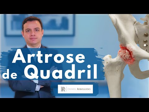 Cum să restaurați articulația genunchiului cu artroză