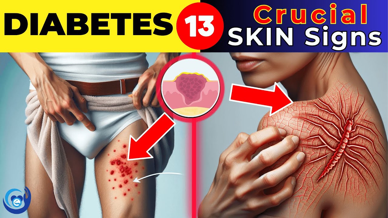 13 crucial skin signs of diabetes