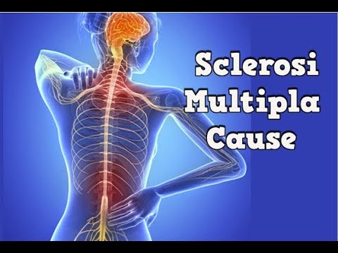 Dolore ai muscoli della schiena Anatomia MRI dellarticolazione della spalla