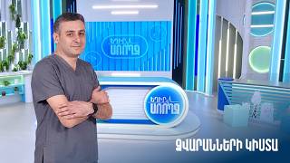 Եղիր առողջ. ձվարանների կիստա