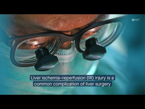 Caspase 6 mediates liver ischemia-reperfusion injury by promoting inflammation and cell death