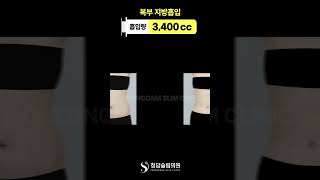 통통배였던 나, 이제는 납작배