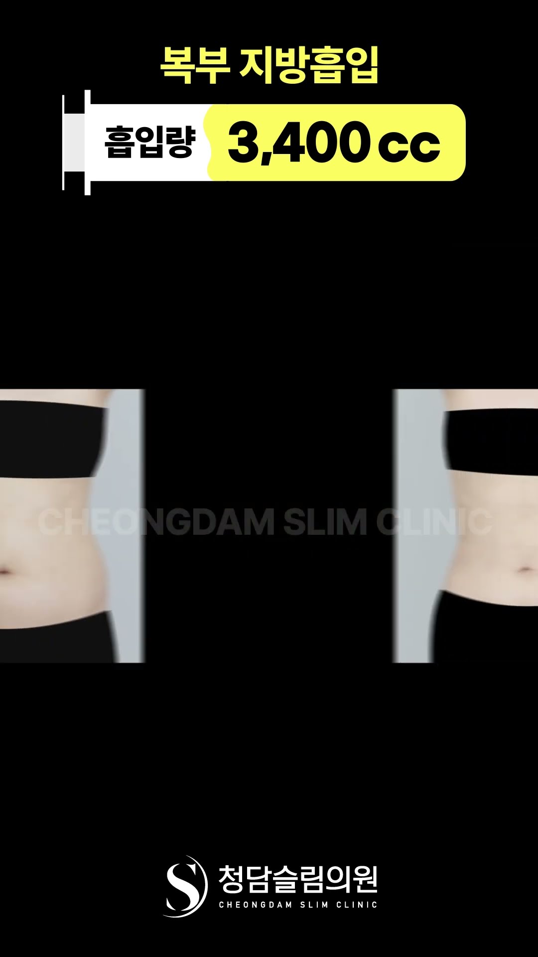 통통배였던 나, 이제는 납작배