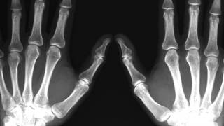 Sparklehorse-My Bloody Hands.m4v