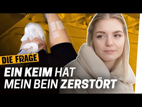 Amputation: 33 Operationen konnten mein Bein nicht retten | Wie komme ich mit meinem Körper klar? #6