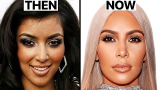 Kim Kardashian's New Face | Plastic Surgery Analysis