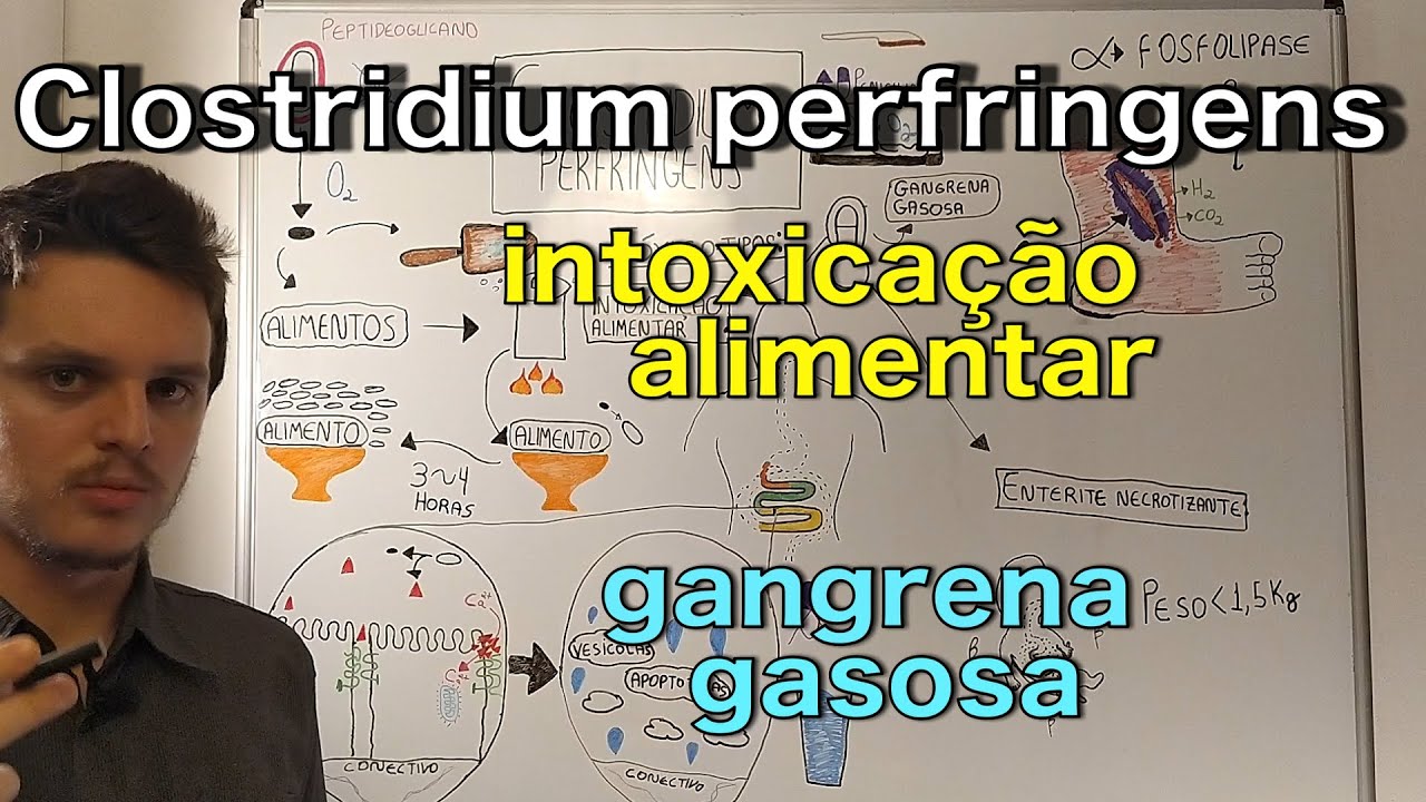 Clostridium perfringes | Curso de bacteriologia | Medicina passo a passo