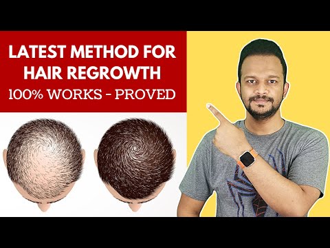 Latest Hair Regrowth Peptides that may replace Hair Transplantation (produces 10000 new hairs)