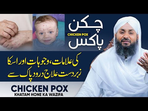 Chicken Pox Khatam Hone Ka Wazifa | Symptoms Treatment | Durood Sharif Ka Wazifa
