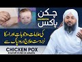 Chicken Pox Khatam Hone Ka Wazifa Symptoms Treatment Durood Sharif Ka Wazifa