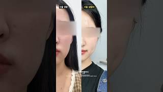 쥬베룩으로 땅콩라인 정리하는 법 🔥