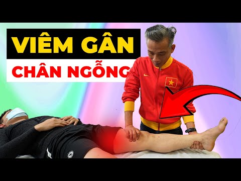 Đau Nhức Đầu Gối Không Thể Đi Bộ? Đây Là Dấu Hiệu Viêm Gân Chân Ngỗng