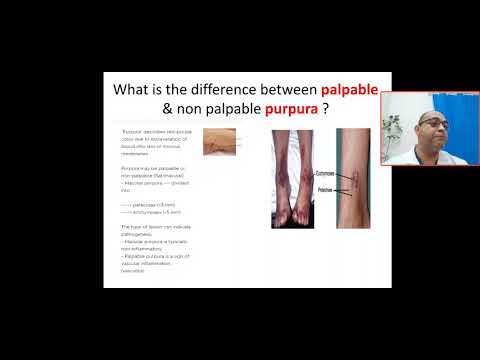 What's the difference between palpable & non palpable purpura? platelet, coagulation, vascular cause