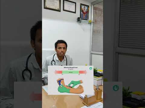 ALBUCEL 25 HUMAN ALBUMIN