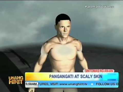 Lunas para sa kuko halamang-singaw upang i-drop arms Pagtatasa para sa kuko halamang-singaw Rostov on Don