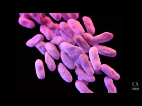 Superbug outbreak linked to  Olympus  TJF-Q180V endoscopes