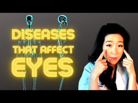 Medical Conditions That Affect The Eye | Diabetes, Thyroid Disease, High Blood Pressure, and More!