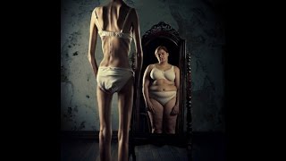 Someone I Once Knew (Anorexia Song) - Dead Celebrity Status (traducida al español)