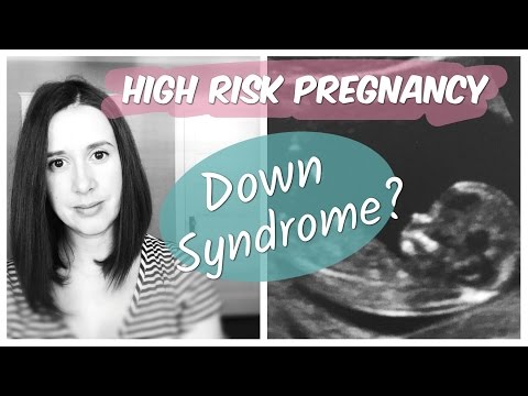 My Baby Might Have Down Syndrome? | High Risk Pregnancy
