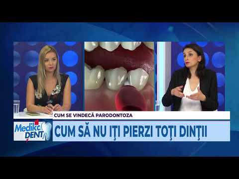 Medika Dent 27.10.2020 – Cum se tratează parodontoza