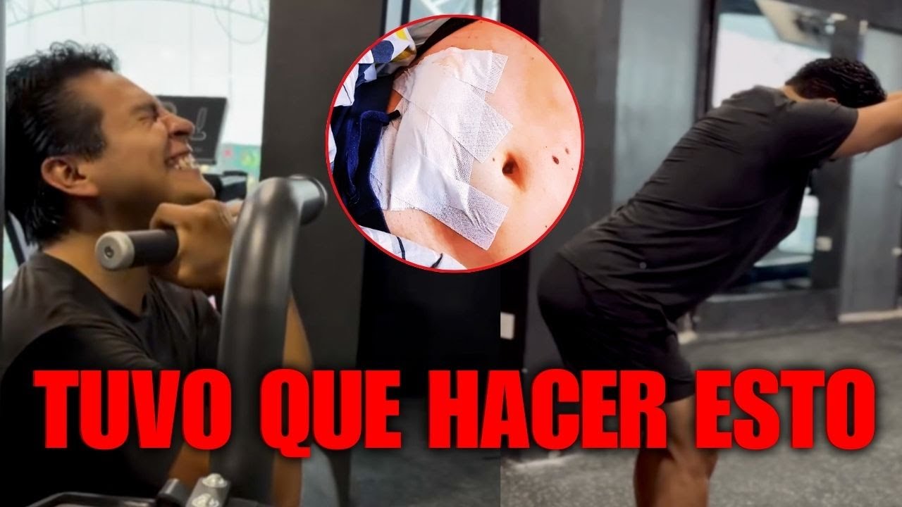 Por esto bajo de peso el ARQUI JUVE