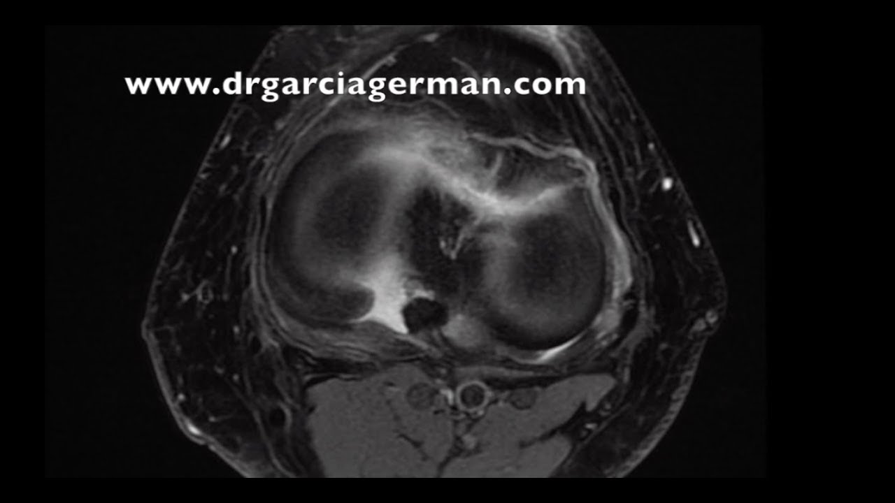 Diego García-Germán Vázquez-15