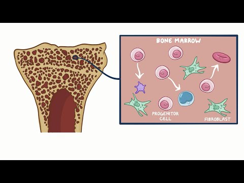Primary Myelofibrosis (PMF): Causes, Symptoms & Diagnosis