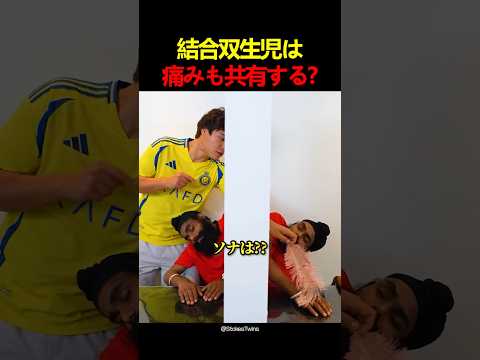 結合双生児は痛みも共有する