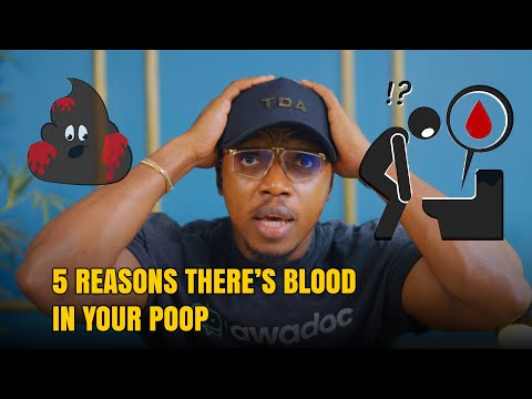 5 reasons why there’s blood in your poo!