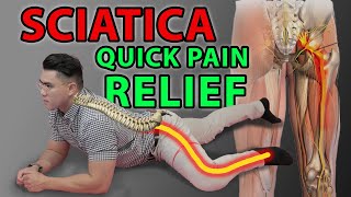 One Minute Sciatica Exercise to Cure Sciatica & Quick Pain Relief | Leg Pain Sciatica Disc Bulges