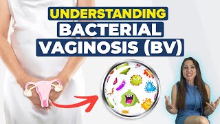 Understanding Bacterial Vaginosis:  A Doctor