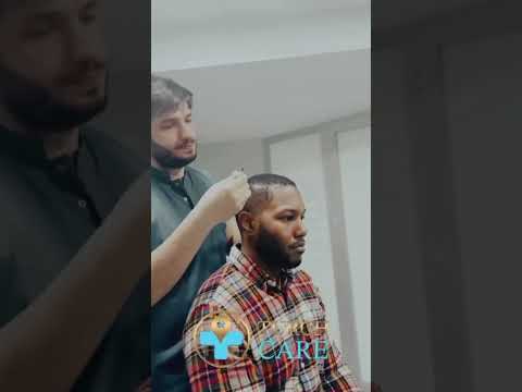 📍From the US to Istanbul – David’s Hair Transplant Journey! 🇺🇸✈️🇹🇷#turchcare 0