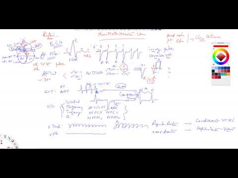 ^MuniSTHealth - #204 What Are Common Rhythms On An ECG?