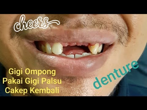 Palsu